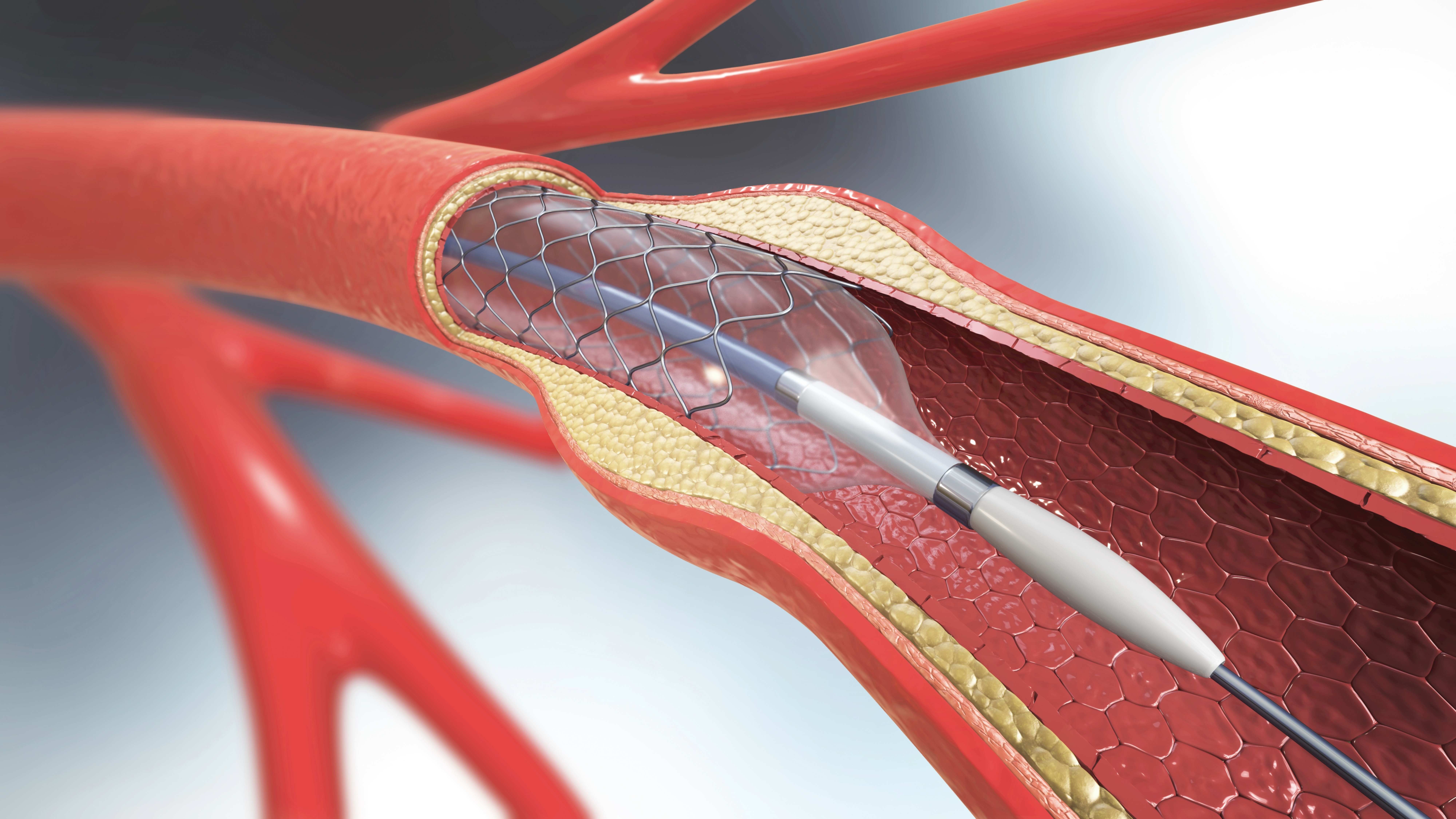 Medical tubing and catheter engineering tools